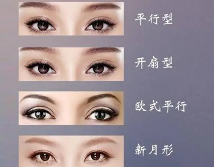青岛双眼皮图片 青岛双眼皮图片
