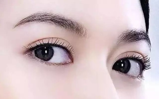 开眼角